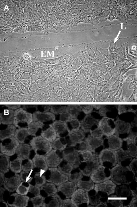 A Phase Contrast Image Of A Wounded Bovine Corneal Endothelial Bce