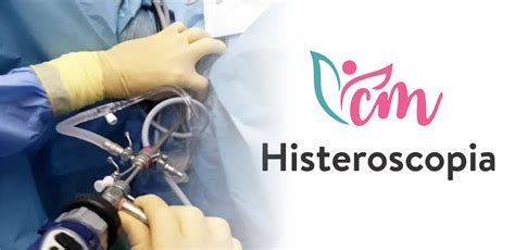 Histeroscopia Cl Nica Dr Mau