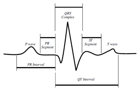 A Typical Ecg Waveform And Its Characteristic Patterns P And T Waves