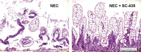 Ileal Structure In Neonatal Rat Model Of Necrotizing Enterocolitis