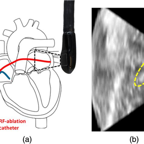 Block Diagram Of The Proposed System For Catheter Segmentation Method Download Scientific Diagram