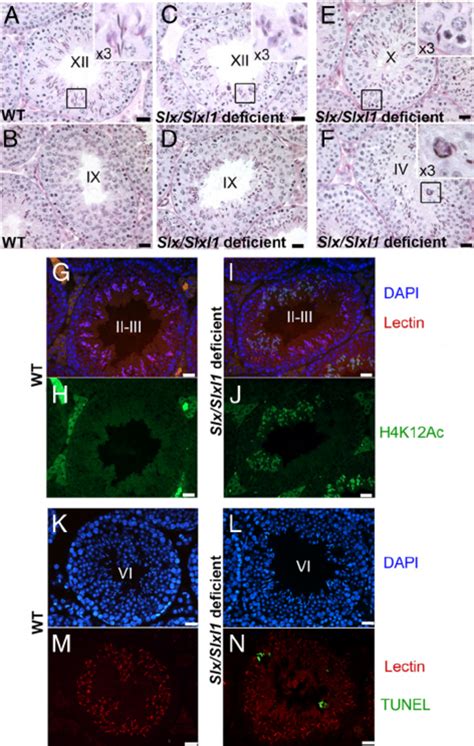 Impaired Spermiogenesis And Increased Apoptosis Of Elongating