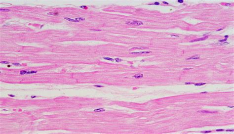 Advancements in Cardiac Tissue Engineering | Aurora Scientific