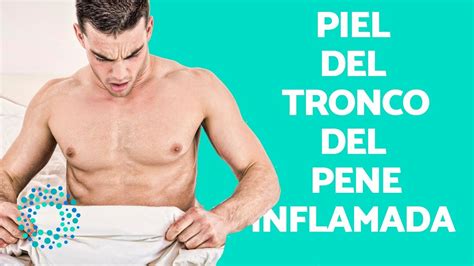 Piel Del Tronco Del Pene Inflamada Youtube