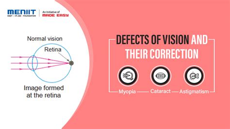 Defects Of Vision And Their Correction Physics Class X Meniit