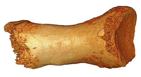 Denisovan Gallery: Tracing the Genetics of Human Ancestors | Live Science