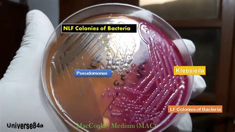 Escherichia Coli Colony Morphology