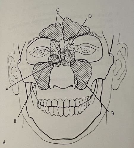 Sinuses Flashcards Quizlet