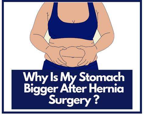 Why Is My Stomach Bigger After Hernia Surgery