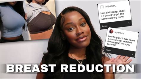 My Breast Reduction Experience How To Get Insurance To Cover Advice