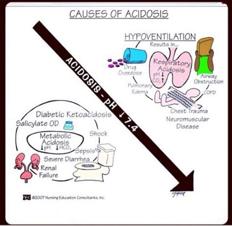 Acidosis Nursing Mnemonics Nurse Nursing Education