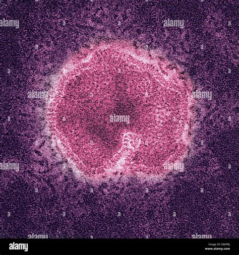 This Colorized Negatively Stained Transmission Electron Micrograph TEM