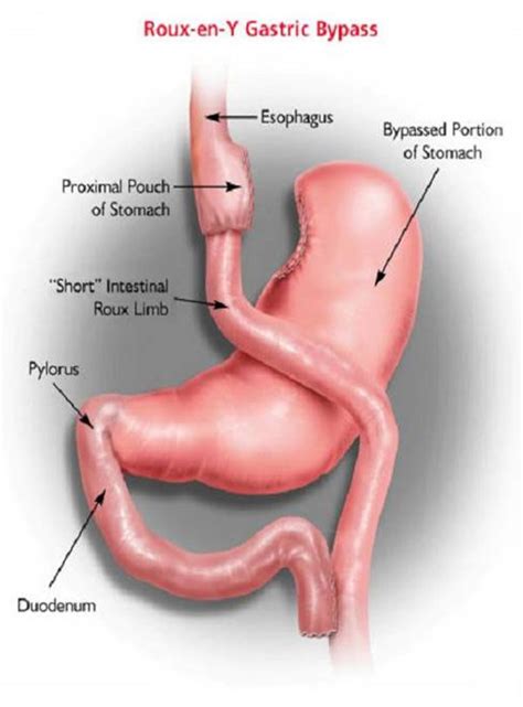 The 2010 Gastrointestinal Surgery Retreat With Poster Session