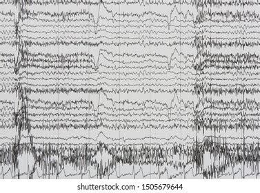 Imaging Brain Waves Electroencephalography Eeg Human Stock Illustration ...