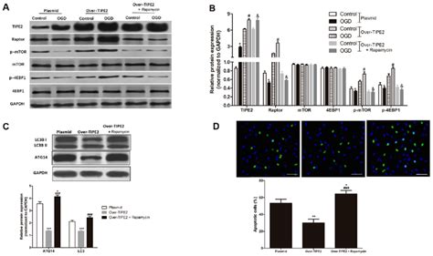 Tipe2 Reduces Autophagy And Ogd Induced Apoptosis In H9c2 Cells By