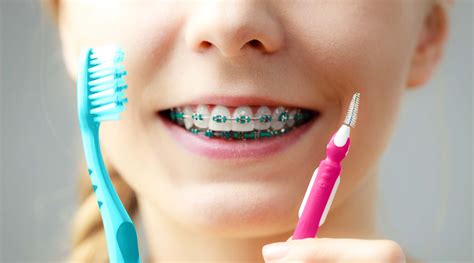 Cómo cepillarse los dientes con brackets | Dental Company