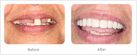 Same Day Smiles Raleigh Periodontics