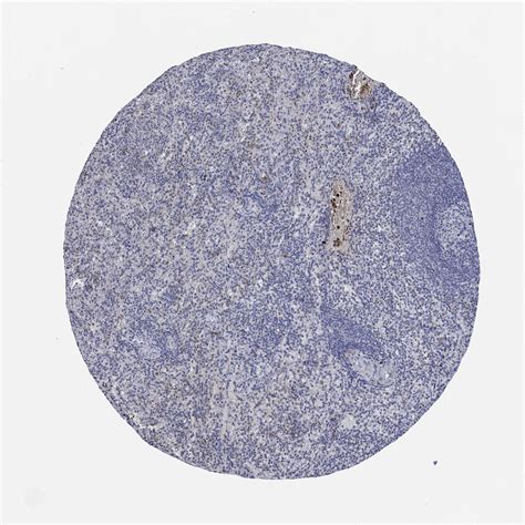 Tissue Expression Of TNF Staining In Spleen The Human Protein Atlas