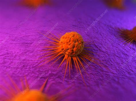 Cancer Cells Artwork Stock Image F004 1445 Science Photo Library