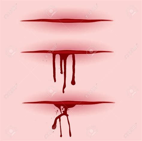 bleeding wound clipart - Clipground