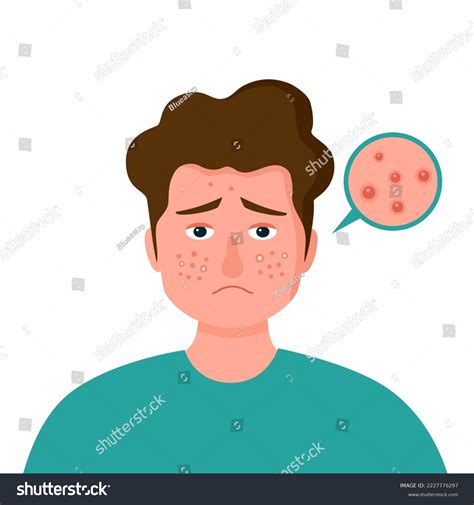 Man Pimple On Face Flat Design Stock Vector (Royalty Free) 2227776297 ...