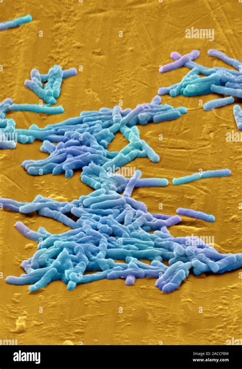 Clostridium Difficile Bacteria Coloured Scanning Electron Micrograph Sem These Rod Shaped