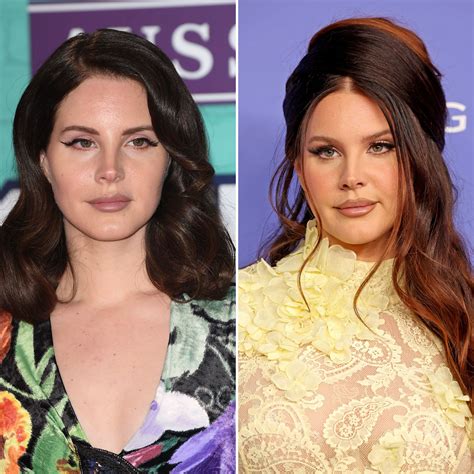 Did Lana Del Rey Get Plastic Surgery? Then and Now Photos | Life & Style