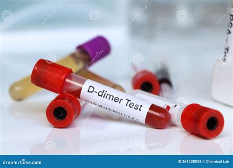 D-dimer Test To Look for Abnormalities from Blood Stock Photo - Image ...