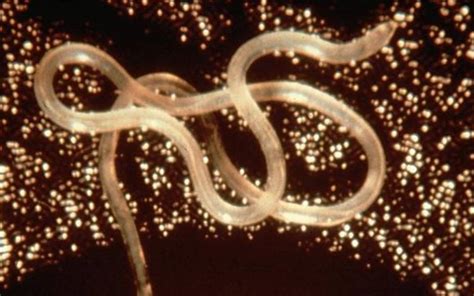 Could playing host to parasitic worms help healthy ageing? | UCL News ...