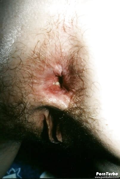 Amateur Asshole Porn Pictures Xxx Photos Sex Images Pictoa
