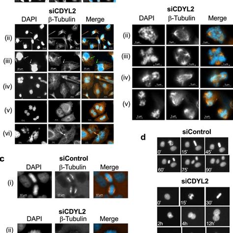 Cdyl Rnai Inhibits Cell Growth Induces Apoptosis And Results In