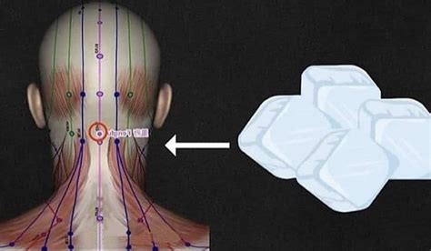 Metti Il Ghiaccio In Questo Punto Del Collo Il Feng Fu Dona Benessere