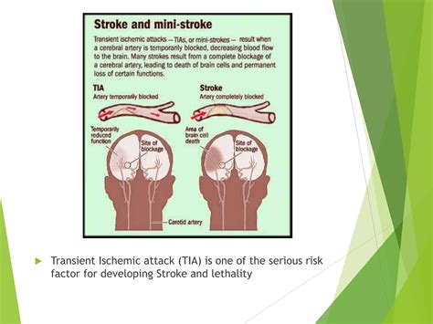 Pathophysiology stroke | PPT