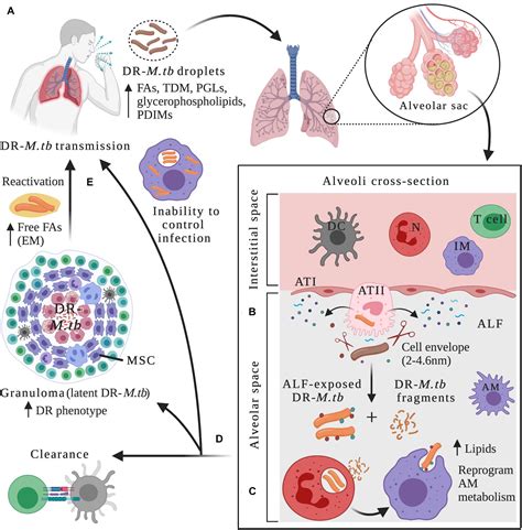 Pulmonary Tuberculosis Pathophysiology Diagram