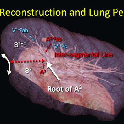 Three Dimensional Computed Tomography Imaging Simulation Using A