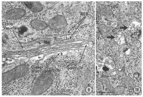 Electron Micrograph Of The Golgi Apparatus In An Intestinal Absorptive