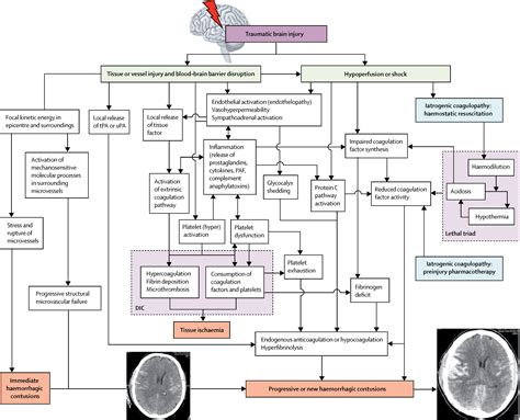 Coagulopathy And Haemorrhagic Progression In Traumatic Brain Injury