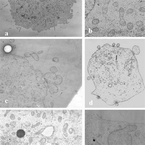 Prostate Cancer Cell Line Pc3 After Etoposide Treatment Apoptotic