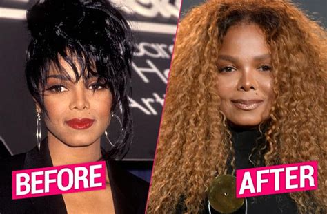 Janet Jackson Shocking Plastic Surgery Makeover Revealed