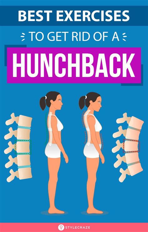 Best Exercises To Get Rid Of A Hunchback | Exercise, Posture exercises, Body posture