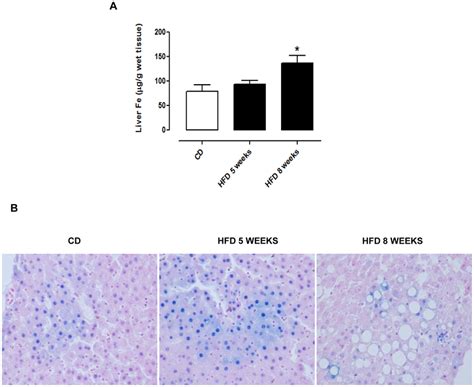 HFD causes iron overload in liver. Tissue iron content was measured by ...