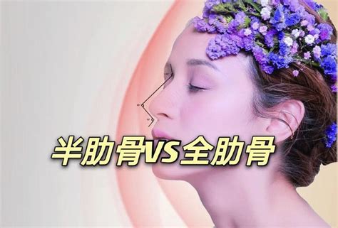 全肋隆鼻vs半肋隆鼻，该如何选择？ 知乎