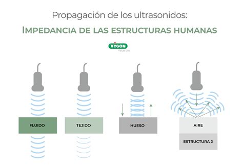 Propagación de los ultrasonidos Impedancia de las estructuras humanas