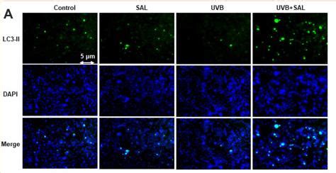 LC3B Antibody Affinity Biosciences