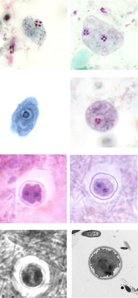 Description Of Dientamoeba Fragilis Cyst And Precystic 46 Off