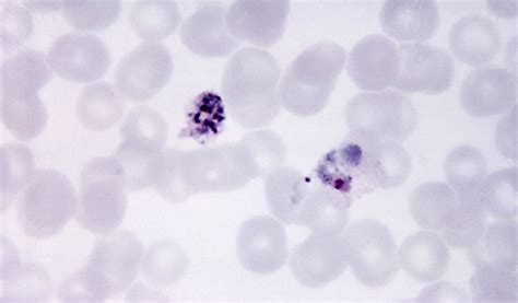 Foto Gratis Microfotografia Immaturo Plasmodium Vivax Schizonte