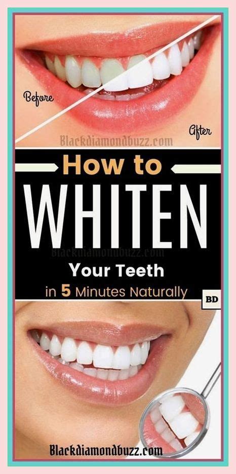 How To Have White Teeth Naturally At Home Works 100 Teeth