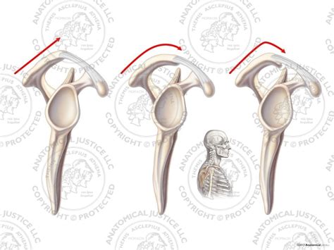 Bigliani Classification Of The Right Acromion Process No Text