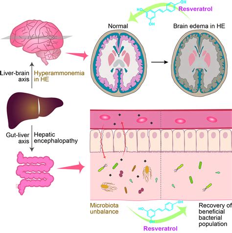 Jcm Free Full Text Therapeutic Applications Of Resveratrol In