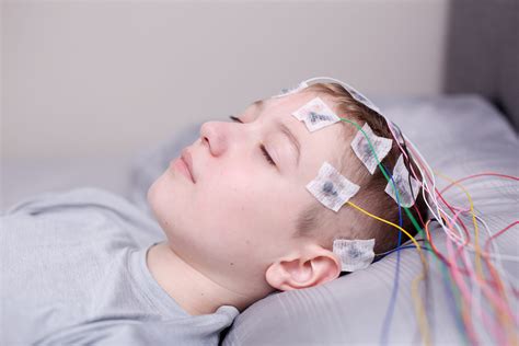 Remote EEG Monitoring for Critically Ill Patients - IntraNerve Neuroscience